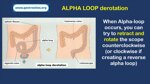 role-of-the-endoscopy-nurse-auxiliary-maneuvers