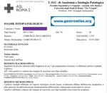 jejunal-adenocarcinoma-in-celiac-disease