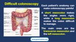 role-of-the-endoscopy-nurse-auxiliary-maneuvers