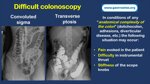 role-of-the-endoscopy-nurse-auxiliary-maneuvers