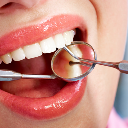 sbiamcamento dentale