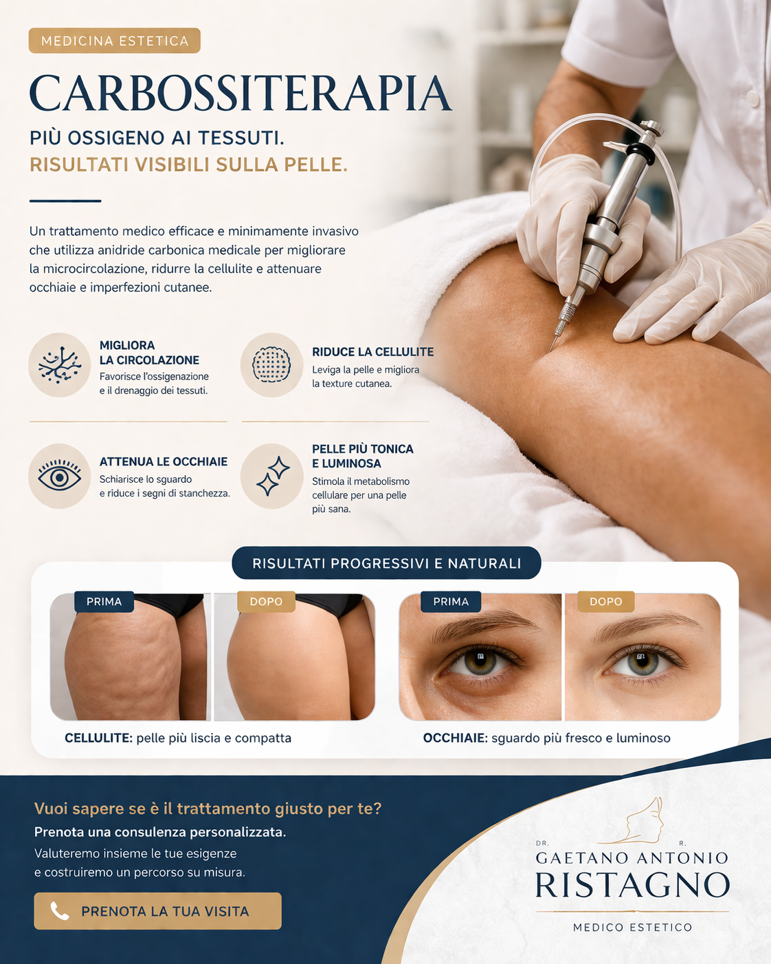 Carbossiterapia: trattamento efficace per cellulite e occhiaie