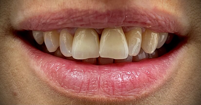 img_20250321_153045_1.heic_compressed.jpeg img_20250321_153045_1.heic_compressed.jpeg