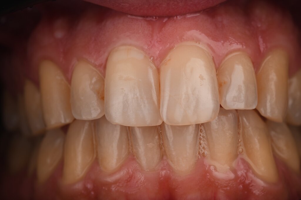 img_7312_compressed.jpeg img_7312_compressed.jpeg