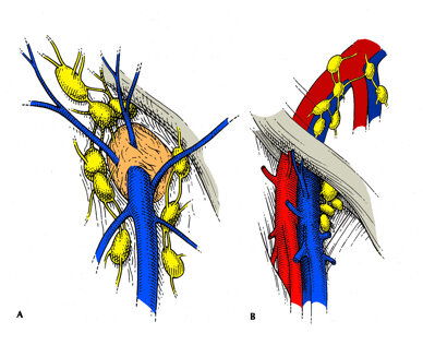 linfonodiinguinali1_bis_2