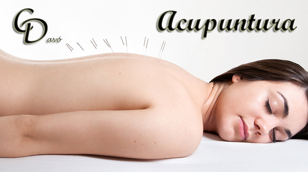 acupuntura copia3.jpeg