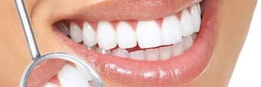 blanqueamento dental.jpeg