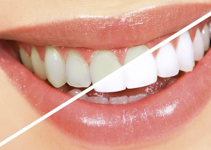 fb228b31-e696-4eab-bb49-5fdb0b91cb62