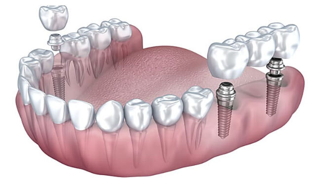 09a2bd77-51bb-4fbc-bd74-16c843254bd3