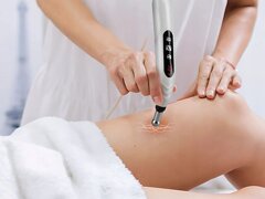 agopuntura elettronica.jpeg