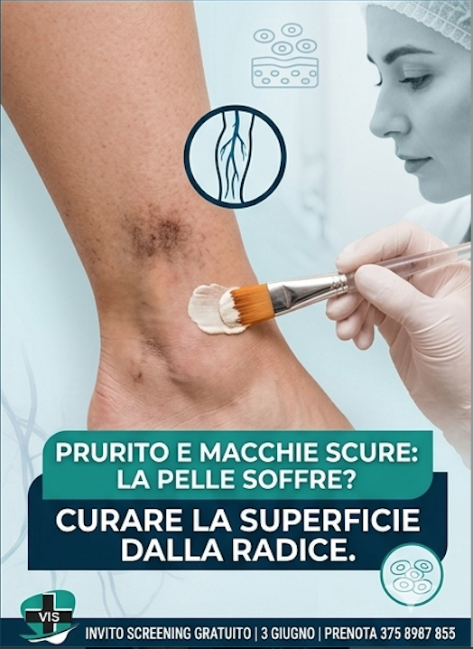 Macchie scure, prurito e pelle secca sulle gambe? La colpa potrebbe essere delle tue vene