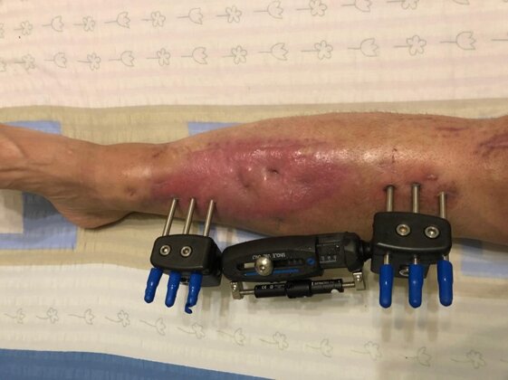 7c1b410a-ebe0-4854-848e-640f6d2e2d47