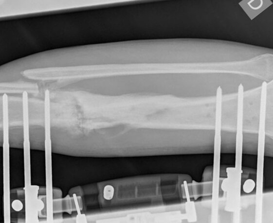 0e4623ea-a1b1-4892-8c36-8a42adaed008