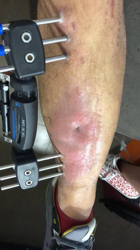 fdd4517c-b839-48b3-ace0-d6ec56d5e7da