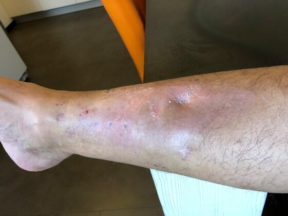 eb035a02-15f3-499e-8c04-e5dfb79ddcc0