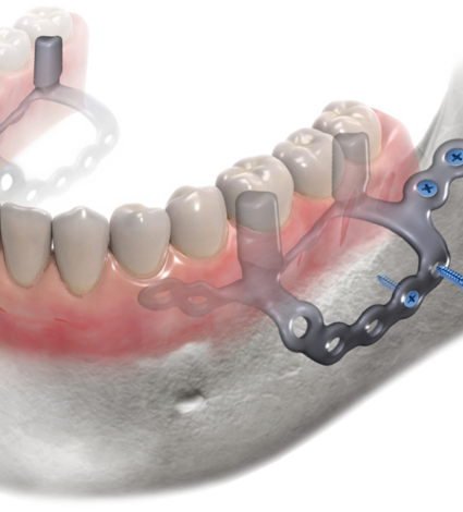 chirurgia dentale