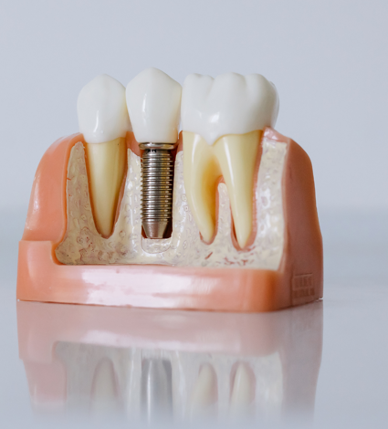 igene e prevenzione dentale 