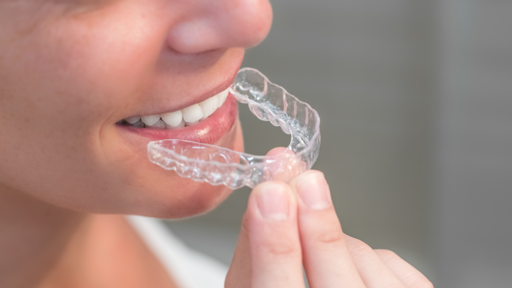 estetica dentale