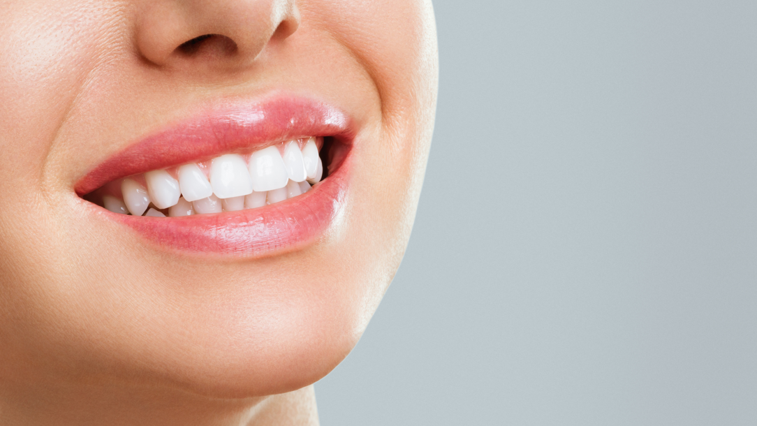 implantologia dentale