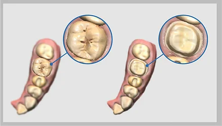 pre-operation20scan_4x
