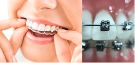 ortodonzia ortodonzia