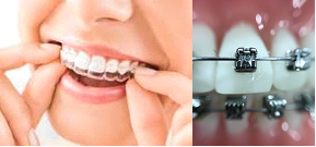 ortodonzia ortodonzia