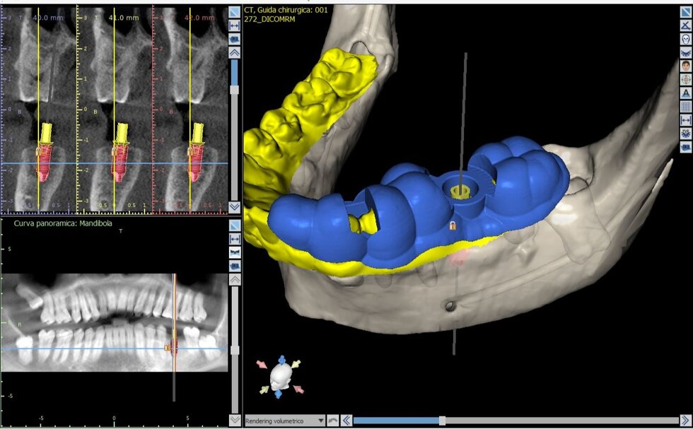 dima_chirurgica.jpeg dima_chirurgica.jpeg