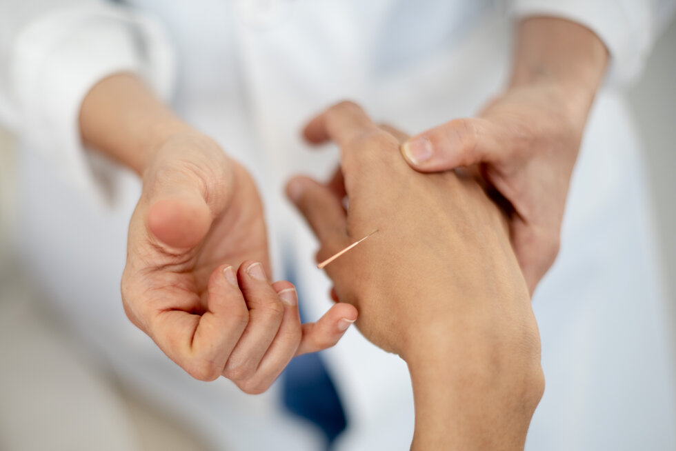 agupuntura 26-7.jpeg agupuntura 26-7.jpeg