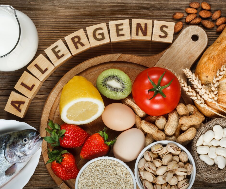 Reazioni alimentari Reazioni alimentari