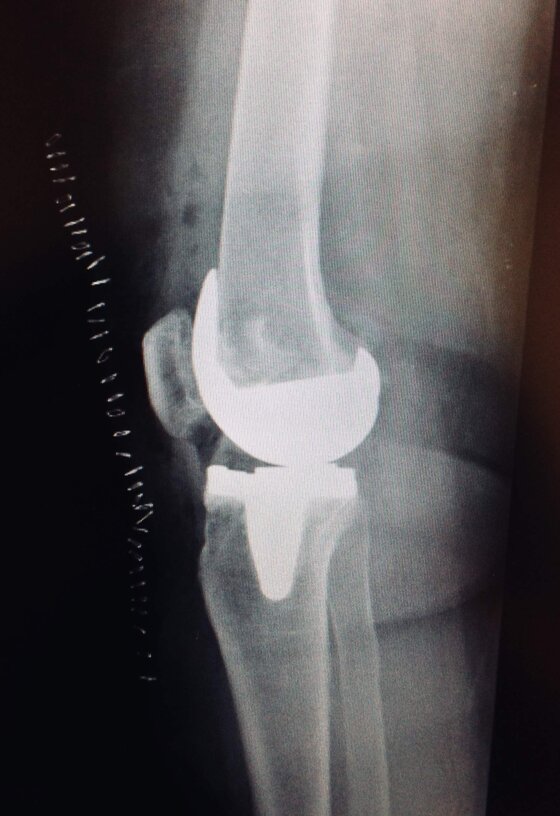 d77cacb5-dcc1-4d1e-bb96-51958af19b09