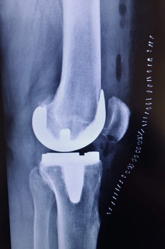 116d3296-d6e9-4955-bdb5-d4c515f13322