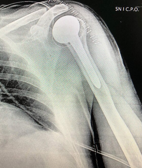 879f1d56-fa2f-4767-8026-2b713d801475