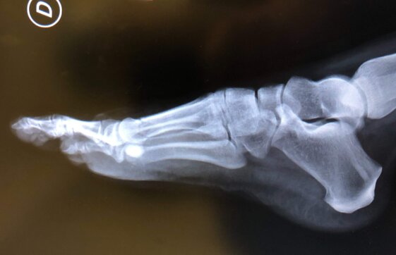 0a1966a4-885f-4b88-abde-2ab580b44dce