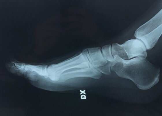 fc6e6af4-7f54-4a50-af9a-5bf3a5d08b0b