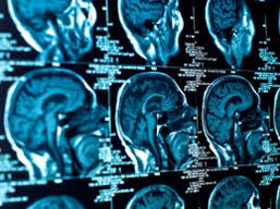 neurologia4 neurologia4