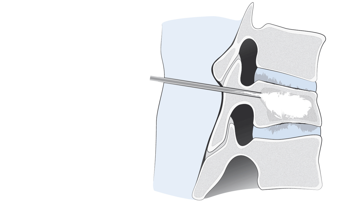 38f66b08-04ac-4c33-9353-05b61318a7c5 38f66b08-04ac-4c33-9353-05b61318a7c5