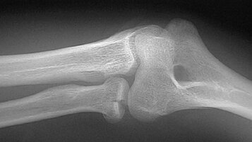 bb8d0abd-f0ff-4652-a16b-98de3dfa4c56 bb8d0abd-f0ff-4652-a16b-98de3dfa4c56