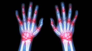 2b1bc608-56d1-42c8-ae3b-6a8d075ceadd