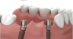 27561_d3ad091890408c917193eafbc8f0a06da3b9086a