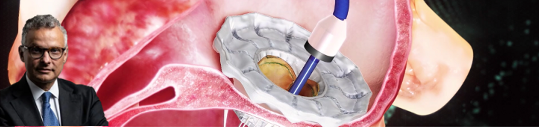 a70b643b-cc9d-4aec-ada4-f0b9ea1355c8