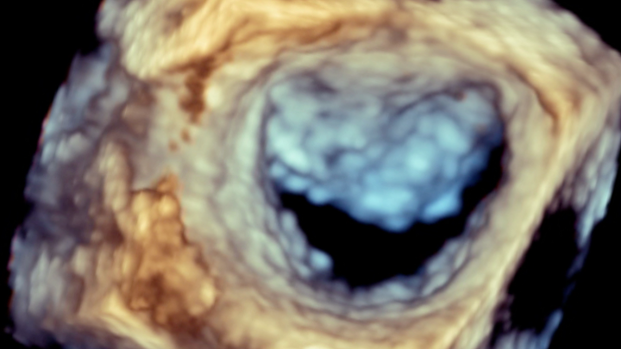 6444346c-b680-4a6d-b85d-7fe22d434756