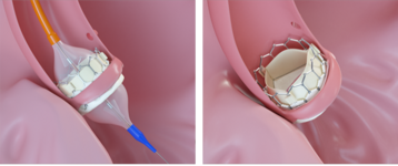 ff54a682-31d6-44fa-9971-7cc2a7367d30