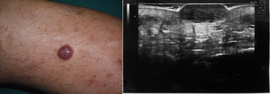 81dc347d-cef8-4d95-bf33-ddb1b4065204 81dc347d-cef8-4d95-bf33-ddb1b4065204