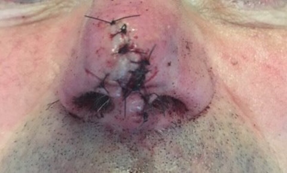 RICOSTRUZIONE PLASTICA RICOSTRUZIONE PLASTICA