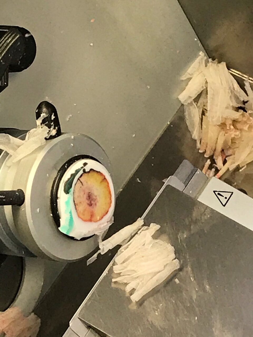 SEZIONE AL CRIOSTATO SEZIONE AL CRIOSTATO