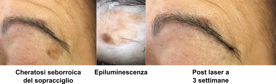 433d7717-bd18-4446-97e5-14d8960174a1 433d7717-bd18-4446-97e5-14d8960174a1