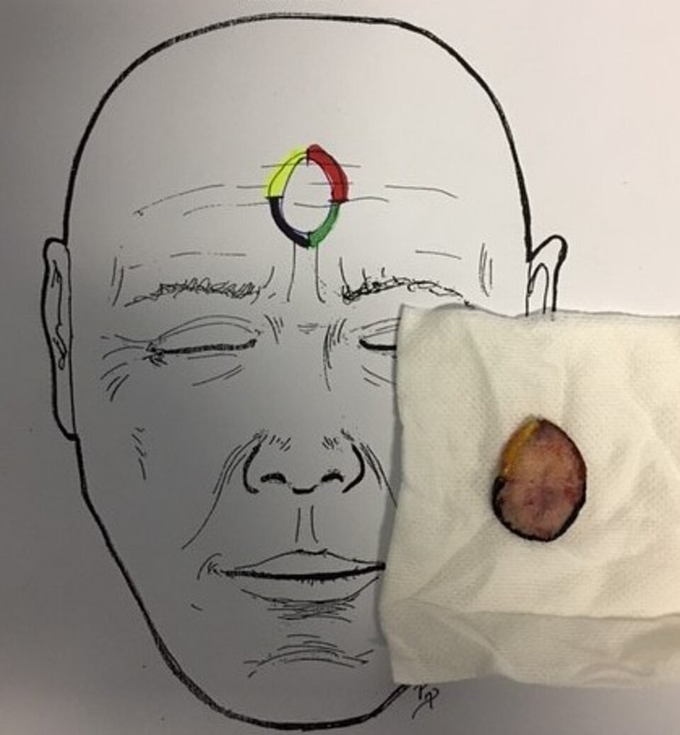 Disegno e mappaggio con coloranti Disegno e mappaggio con coloranti