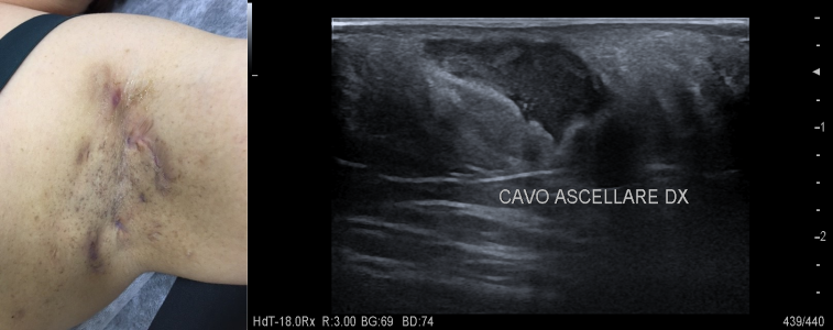 bb95e223-516e-4f0f-b3c4-92b2eec9a6ab bb95e223-516e-4f0f-b3c4-92b2eec9a6ab