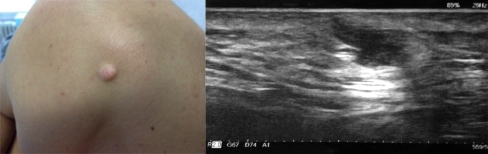 abd5cbbe-36b8-4aa2-a86c-fa72dcc7423d abd5cbbe-36b8-4aa2-a86c-fa72dcc7423d