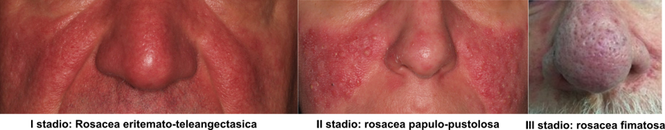 05b859d6-6225-4221-b2f7-2465b6136467 05b859d6-6225-4221-b2f7-2465b6136467